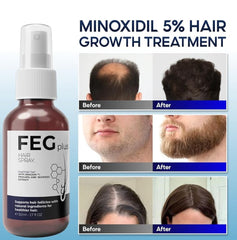 FEG Plus Hair Growth Spray (Original)